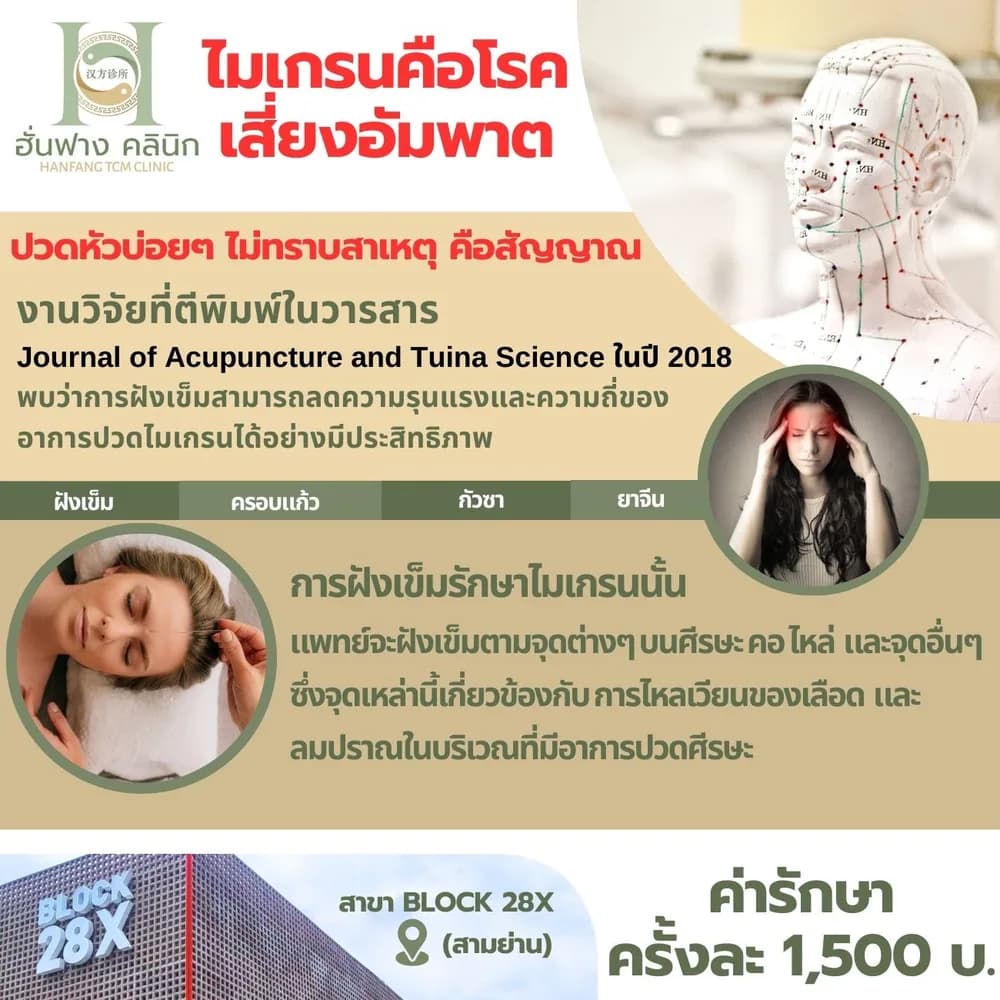 ฝังเข็มรักษาไมเกรนที่ฮั่นฟาง คลินิก มีงานวิจัยรองรับ