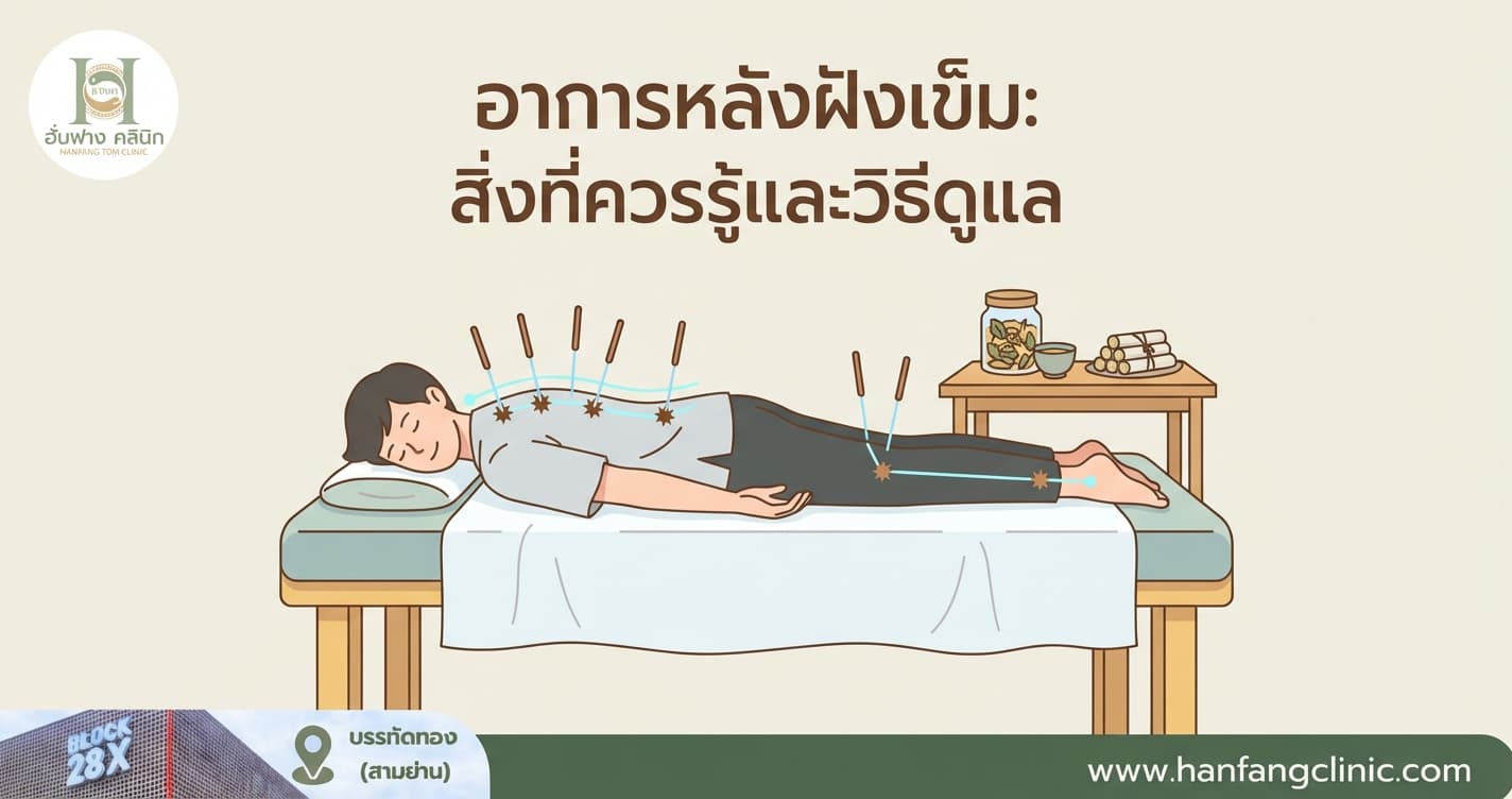อาการหลังฝังเข็ม: สิ่งที่ควรรู้และวิธีดูแล