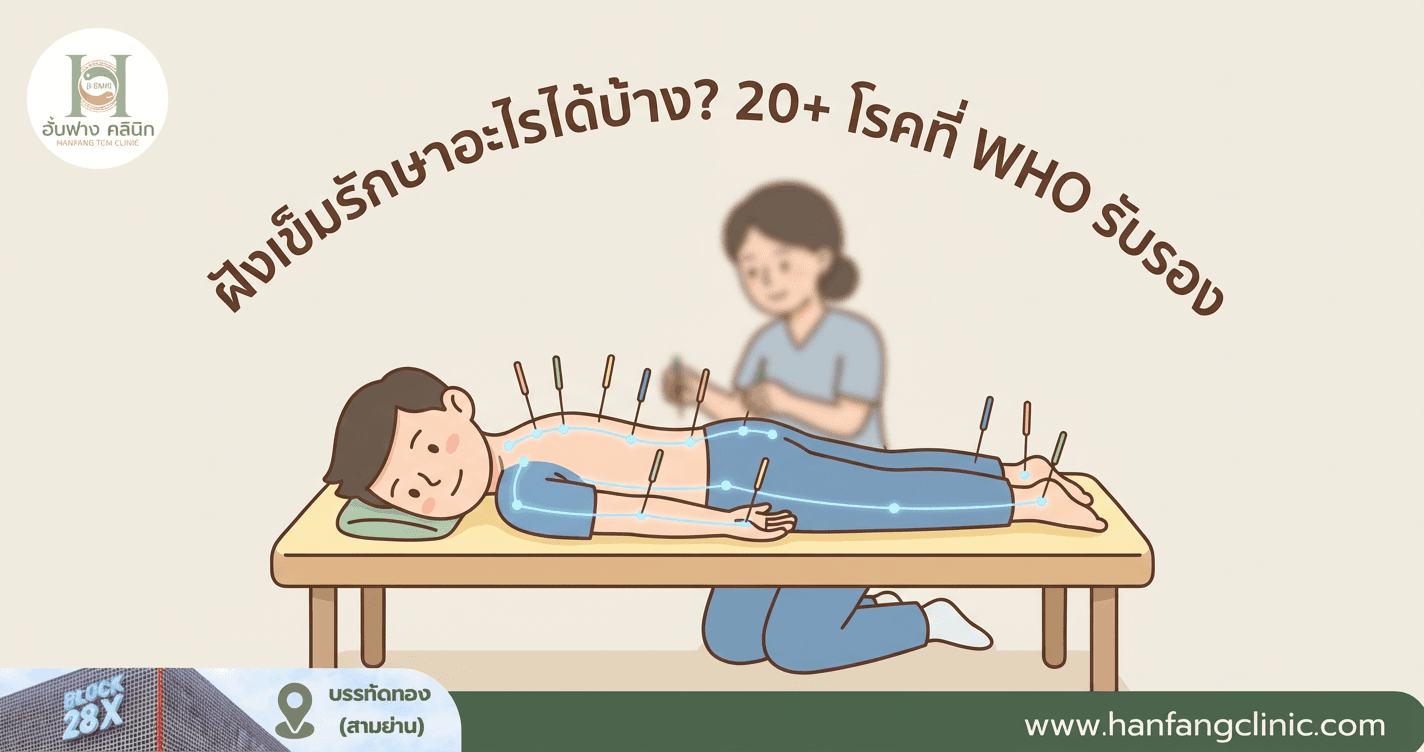 ฝังเข็มรักษาอะไรได้บ้าง? 20+ โรคที่ WHO รับรอง
