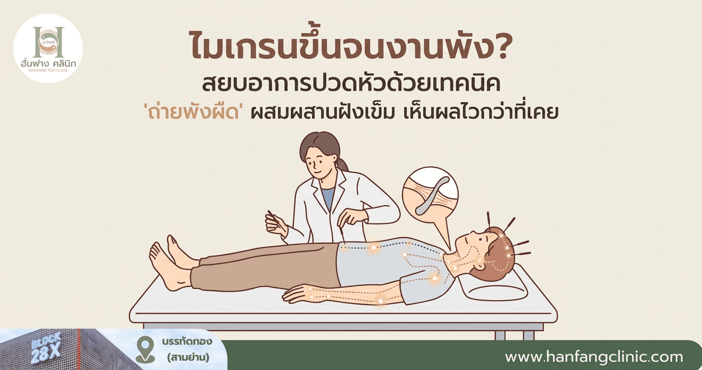 ไมเกรนขึ้นจนงานพัง? สยบอาการปวดหัวด้วยเทคนิค 'ถ่ายพังผืด' ผสมผสานฝังเข็ม เห็นผลไวกว่าที่เคย